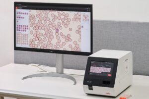 Benin enlists Korean-developed AI in nationwide battle against malaria - The Korea Times