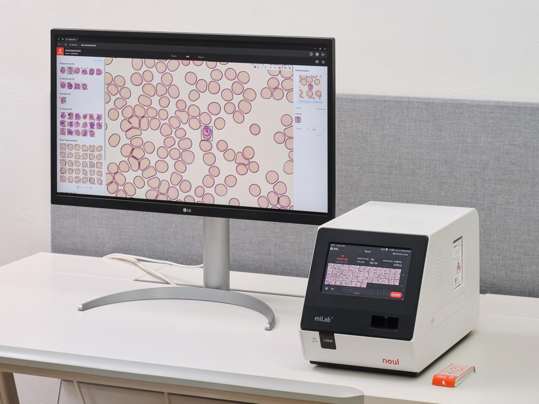 Benin enlists Korean-developed AI in nationwide battle against malaria - The Korea Times